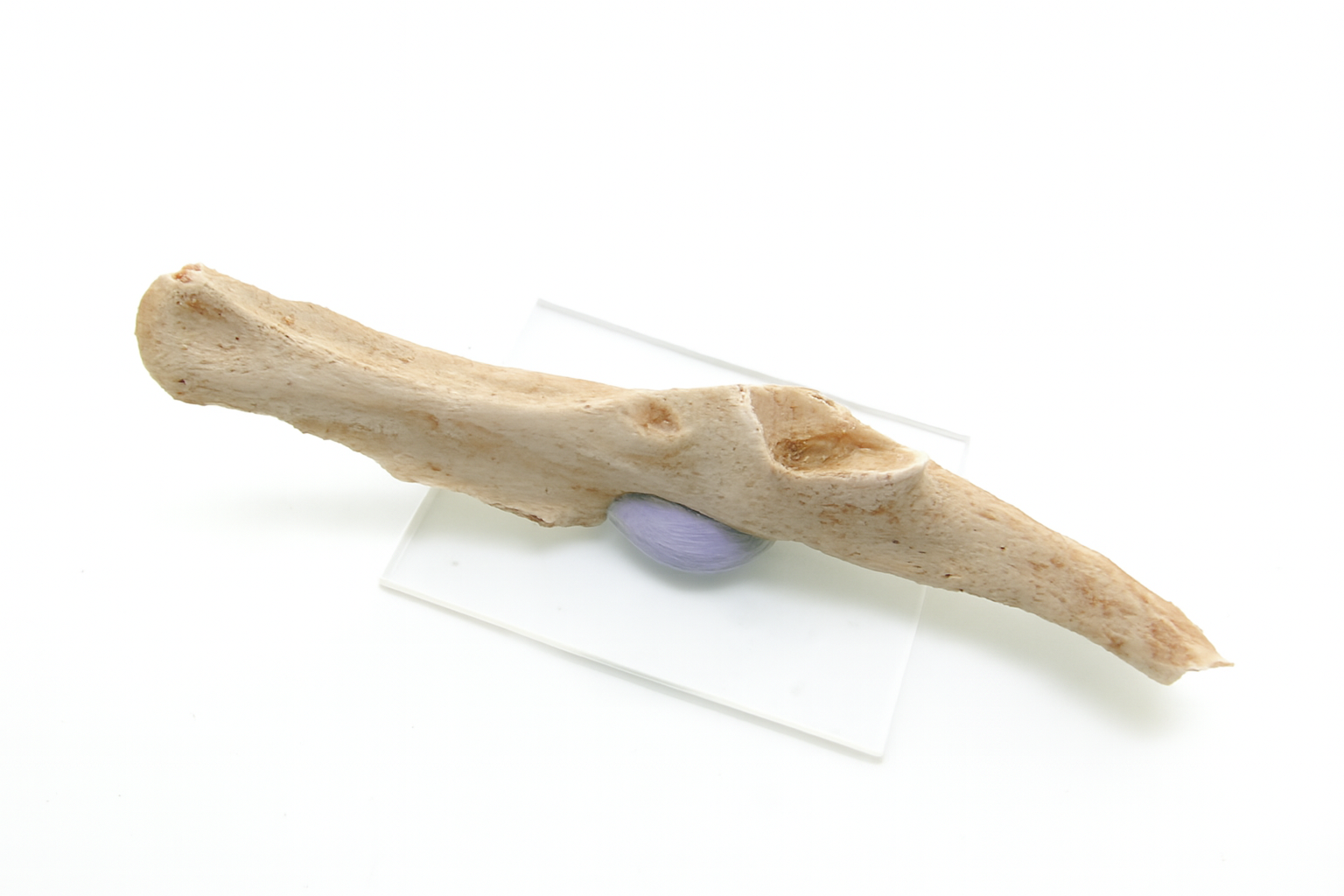 Bone